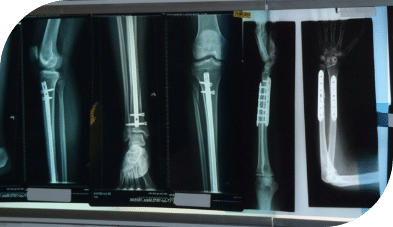 1760653676 imageC 1 Orthopedic Services in East Brunswick, NJ